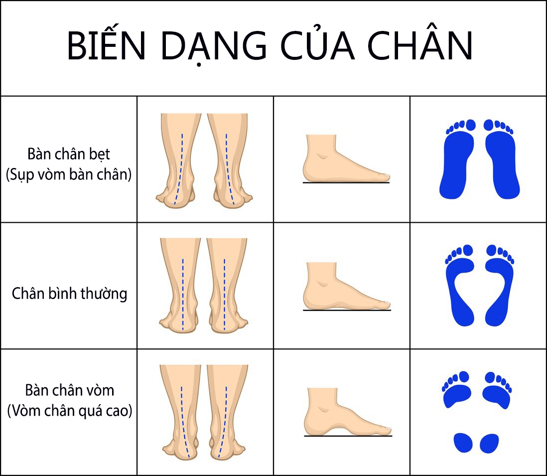 Trẻ có 2 đặc điểm này ở chân tương lai cao vượt trội nhưng 4 điều này lại  nguy hiểm
